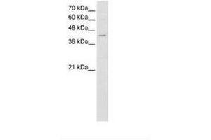Image no. 1 for anti-Fatty Acid Desaturase 1 (FADS1) (AA 428-477) antibody (ABIN204996) (FADS1 Antikörper  (AA 428-477))