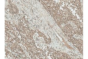 Immunohistochemistry analysis using Rabbit Anti-IGF-1 Polyclonal Antibody (ABIN5066645). (IGF1 Antikörper  (Atto 594))