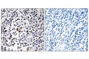 Immunohistochemistry analysis of paraffin-embedded human lymph node tissue using CD302 antibody. (DCL1 Antikörper  (Internal Region))