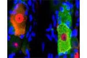 IF on rat trigeminal using Mouse monoclonal antibody to rat p75NTR (ABIN350707) at a concentration of 10 µg/ml, Rabbit antibody to internal part of cFos (c-fos): whole serum (ABIN350207) at 1 : 500 dilution and DAPI counterstained. (NGFR Antikörper)