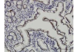 Image no. 2 for anti-Apoptosis Inhibitor 5 (API5) (AA 400-504) antibody (ABIN466131) (Apoptosis Inhibitor 5 Antikörper  (AA 400-504))