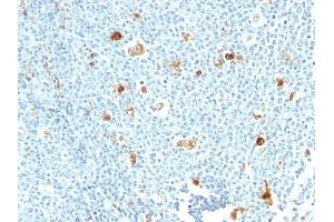 Formalin-fixed, paraffin-embedded human tonsil stained with Calprotectin Monoclonal Antibody (CPT/1028) (S100A9 Antikörper)