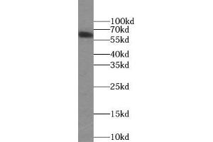WB analysis of HepG2 cells subjected to SDS-PAGE, using PLAP antibody (1/1000 dilution). (PLAP Antikörper)
