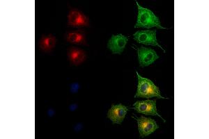 ABIN6265576 and ABIN6273176 staining HUVEC cells by IF/ICC. (TIMM44 Antikörper  (N-Term))