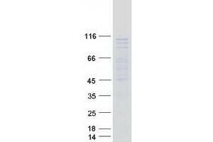 Validation with Western Blot (UTP25/DIEXF Protein (Myc-DYKDDDDK Tag))