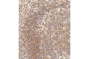 Immunohistochemistry (Paraffin-embedded Sections) (IHC (p)) image for anti-Epithelial Cell Adhesion Molecule (EPCAM) (AA 59-86) antibody (ABIN1539958)