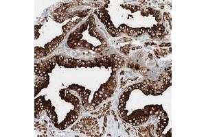 Immunohistochemical staining of human prostate with LOC201229 polyclonal antibody  strong cytoplasmic positivity in glandular cells at 1:20-1:50 dilution. (LYRM9 Antikörper)