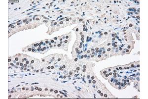 Immunohistochemical staining of paraffin-embedded Ovary tissue using anti-SSBmouse monoclonal antibody. (SSB Antikörper)