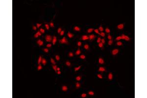ABIN6267695 staining K562 by IF/ICC. (RPS6KB2 Antikörper  (pSer423))