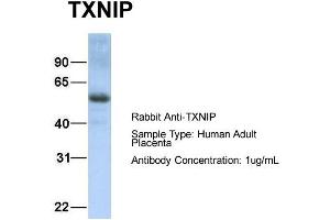 Host: Rabbit Target Name: TXNIP Sample Type: Human Adult Placenta Antibody Dilution: 1.
