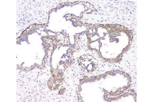 IHC analysis of RMI2 using anti-RMI2 antibody (ABIN6719656).
