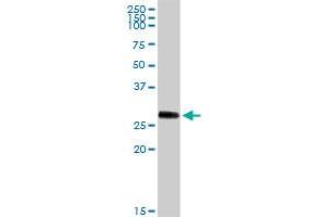 PRSS1 MaxPab rabbit polyclonal antibody. (PRSS1 Antikörper  (AA 1-247))