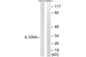 Western blot analysis of extracts from COLO cells, using IL15RA antibody. (IL15RA Antikörper  (Internal Region))