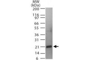 Western blot analysis of Tnfsf11 in a partial His-tagged recombinant protein. (RANKL Antikörper  (AA 161-177))