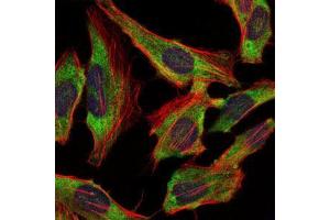 Immunofluorescence analysis of Hela cells using NEFL mouse mAb (green). (NEFL Antikörper)