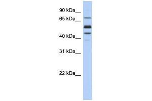 WB Suggested Anti-PROS1 Antibody Titration: 0. (PROS1 Antikörper  (Middle Region))