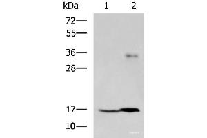 Western blot analysis of A172 cell and Human cerebrum tissue lysates using TMEM42 Polyclonal Antibody at dilution of 1:800 (TMEM42 Antikörper)