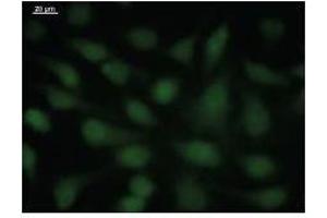 Immunostaining analysis in HeLa cells. (SOX4 Antikörper)