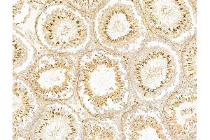 SCAMP2 Antibody at 1/100 staining Rat testis tissue by IHC-P.