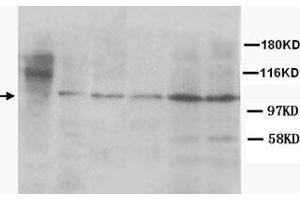 Western Blot analysis of CUL4B expression from cell and tissue extracts with CUL4B polyclonal antibody . (Cullin 4B Antikörper)