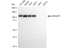 Western blotting analysis using ARHGEF1 antibody (ABIN7800200).