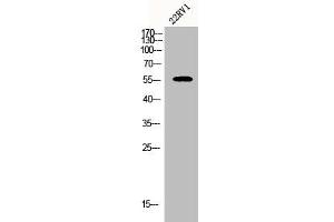 Western Blot analysis of 22RV1 cells using CYP2A7 Polyclonal Antibody (CYP2A7 Antikörper  (C-Term))