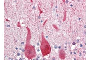 Human Brain, Cerebellum (formalin-fixed, paraffin-embedded) stained with ALDOCfollowed by biotinylated goat anti-rabbit IgG secondary antibody, alkaline phosphatase-streptavidin and chromogen. (ALDOC Antikörper  (C-Term))