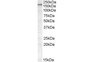 Image no. 1 for anti-ATP-Binding Cassette, Sub-Family A (ABC1), Member 9 (ABCA9) (Internal Region) antibody (ABIN374986) (ABCA9 Antikörper  (Internal Region))