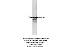 Image no. 1 for anti-Peripherin (PRPH) (full length) antibody (ABIN363318) (Peripherin Antikörper  (full length))