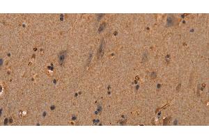 Immunohistochemistry of paraffin-embedded Human brain tissue using COL18A1 Polyclonal Antibody at dilution 1:40 (COL18A1 Antikörper)