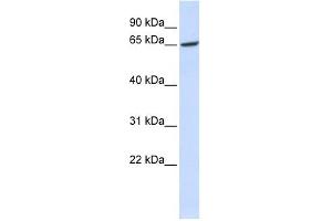 GPR177 antibody used at 1 ug/ml to detect target protein. (GPR177/WLS Antikörper  (Middle Region))