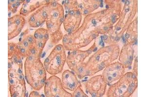 Immunohistochemistry (IHC) image for anti-Carbonic Anhydrase 12 (CA12) (AA 154-307) antibody (ABIN7437902)