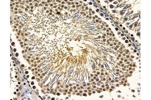 anti-Regulatory Factor X 2 (RFX2) antibody