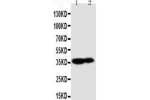 Anti-Kallikrein 9 antibody, Western blotting Lane 1: MCF-7 Cell Lysate Lane 2: A431 Cell Lysate (Kallikrein 9 Antikörper  (C-Term))