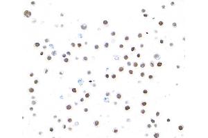 Immunocytochemistry (ICC) image for anti-Spleen Focus Forming Virus (SFFV) Proviral Integration Oncogene Spi1 (SPI1) (AA 1-50) antibody (ABIN7453984)