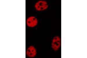 ABIN6272261 staining COLO205 by IF/ICC. (CEBPZ Antikörper  (N-Term))