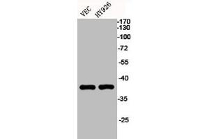 Western Blot analysis of VEC HY926 cells using EKLF/CKLF/UKLF Polyclonal Antibody (KLF1/5/7 Antikörper  (C-Term))