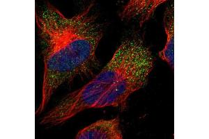 Immunofluorescent staining of human cell line U-251 MG shows localization to vesicles. (CNTF Antikörper  (AA 105-198))