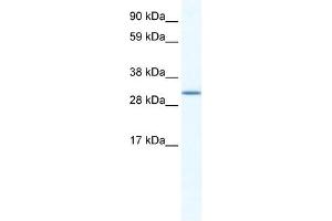 SPIC antibody (20R-1185) used at 5 ug/ml to detect target protein. (SPIC Antikörper  (N-Term))