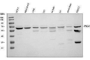 Western blot analysis of PKM2 using anti-PKM2 antibody (ABIN3043381). (PKM Antikörper  (N-Term))