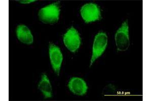Immunofluorescence of purified MaxPab antibody to CYB5R3 on HeLa cell.