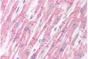 Human Heart (formalin-fixed, paraffin-embedded) stained with BCL2L11 antibody ABIN213909 at 5 ug/ml followed by biotinylated goat anti-rabbit IgG secondary antibody ABIN481713, alkaline phosphatase-streptavidin and chromogen. (BIM Antikörper  (Internal Region))