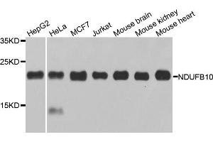 Western blot analysis of extracts of various cell lines, using NDUFB10 antibody. (NDUFB10 Antikörper)