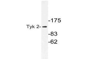 Western blot (WB) analysis of Tyk 2 antibody in extracts from 293cells. (TYK2 Antikörper)
