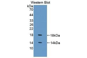 Detection of Recombinant FABP4, Chicken using Polyclonal Antibody to Fatty Acid Binding Protein 4 (FABP4)