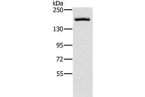 Western Blot analysis of Hela cell using ERBB4 Polyclonal Antibody at dilution of 1:200 (ERBB4 Antikörper)