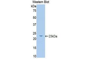 Western Blotting (WB) image for anti-Glucokinase (Hexokinase 4) Regulator (GCKR) (AA 90-286) antibody (ABIN1078068) (GCKR Antikörper  (AA 90-286))