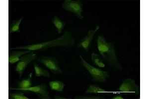 Immunofluorescence of purified MaxPab antibody to PPP6C on HeLa cell. (PPP6C Antikörper  (AA 1-305))