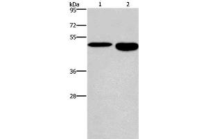 Western Blot analysis of Mouse stomach and brain tissue using DMRT3 Polyclonal Antibody at dilution of 1:550 (DMRT3 Antikörper)