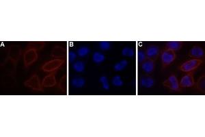 Expression of STIM1 in RBL cells - Cell surface detection of STIM1 in live RBL cells. (STIM1 Antikörper  (Extracellular) (Atto 550))